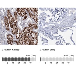 Choline dehydrogenase Antibody, Novus Biologicals:Antibodies:Primary Antibodies